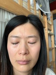 体验后-上海玫瑰医疗美容医院