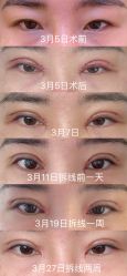 体验前-Yestar艺星医疗美容医院