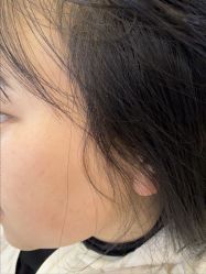 -长沙雅美医疗美容医院