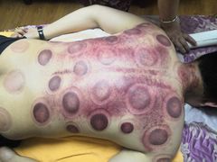 -沈师傅盲人按摩工作室(密三小区店)