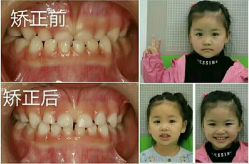 -青苗儿童口腔(长楹天街购物中心)