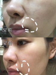 -安徽合肥韩美整形外科医院