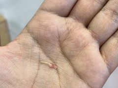 -世龙世家甲沟炎·灰指甲·嵌甲矫正·修脚(武侯区双楠店)