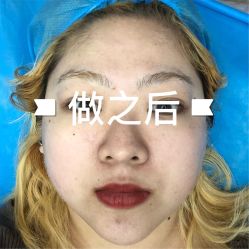 -小忠丽格医美