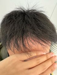 -熙朵美学植发·连锁品牌