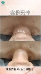 -半岛故事·法儿曼抗衰·indiba中心
