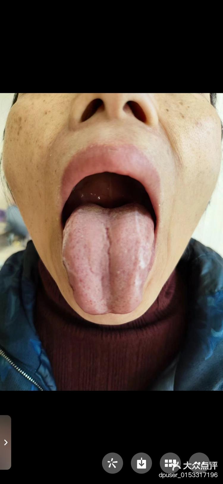 看这一些舌头中医的舌诊可以望色形凹凸等分析身体寒热阴阳