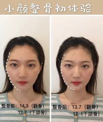 -LUNA皮相美·骨相美高级美感