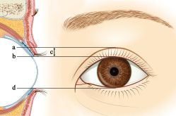 -丰联丽格医疗美容·联合丽格眼整形中心