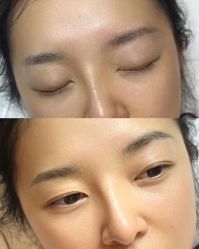 -德绣·机器野生眉发际线·美瞳线半永久