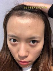 -雍禾植发全国连锁