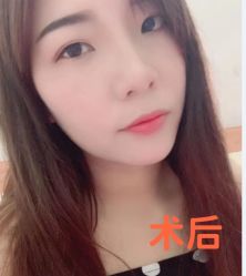 -天津健丽·去眼袋医疗美容机构