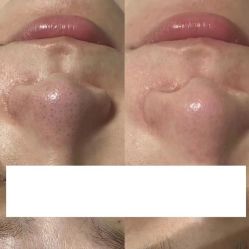 点击看大图 -栖SPA·ONDA ·海菲秀·皑皑科技美肤中心