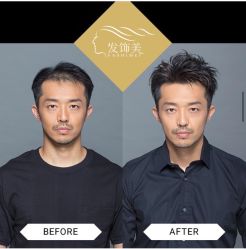 -发饰美男士增发补发假发定制店