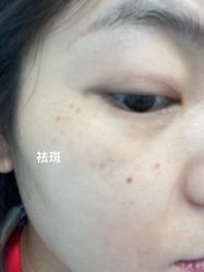 体验后-海峡医疗美容医院