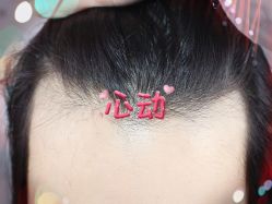 -大麦微针植发全国连锁