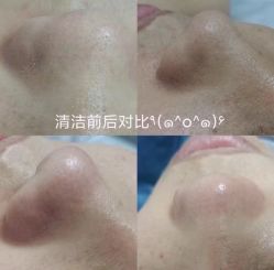 -艾尚妮·美容美体SPA