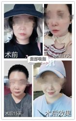 -八大处整形