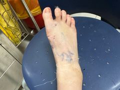 -复旦大学附属华山医院(总院)