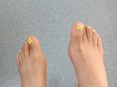 -新甲连锁灰指甲·甲沟炎·鸡眼(黑龙江路店)