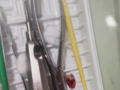 -上海仁爱医院口腔科 · 种植