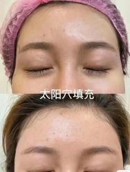 -深圳艺星医疗美容医院