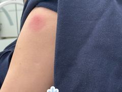 -首都医科大学附属北京潞河医院