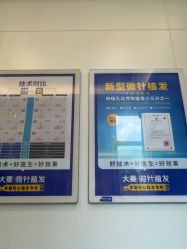 -大麦微针植发全国连锁