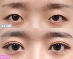 -SKINIST丽铂医疗美容