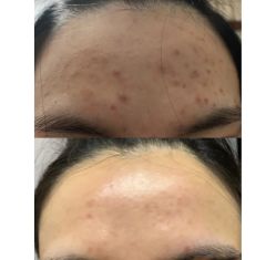 -瓷肌博士·祛痘科技美肤