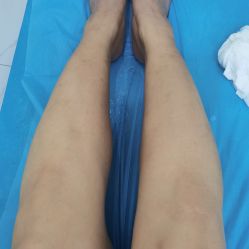 点击看大图 体验后-杭州奥拉克医疗美容门诊部