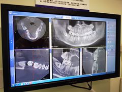 -Dr.Z dental仁康种植矫正中心