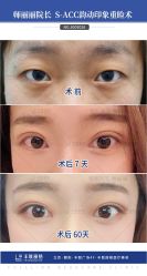 -丰联丽格医疗美容·联合丽格眼整形中心