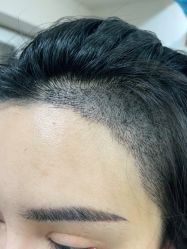 -熙朵美学植发·连锁品牌