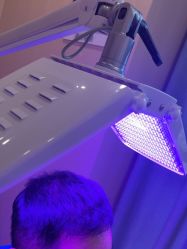 -碧莲盛·不剃发植发