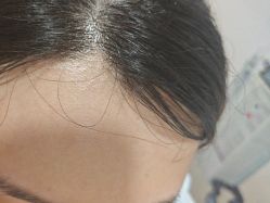 -安徽合肥韩美整形外科医院