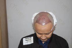 -熙朵美学植发·连锁品牌