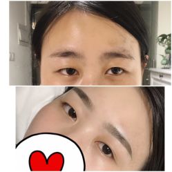 -Doris多里斯半永久纹眉·SMP纹发·发际线