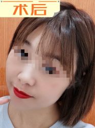 -素美医疗美容·西南眼鼻整形·修复基地