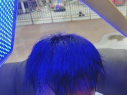 -碧莲盛·不剃发植发
