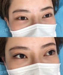-西施无菌半永久纹绣眉眼影唇轻增发纹发际线