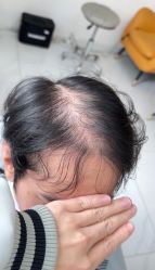 -发饰美男士增发补发假发定制店