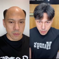 -型男帮男士假发补发·佩戴式发型
