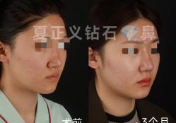 -北京米扬丽格医疗美容·联合丽格鼻整形中心