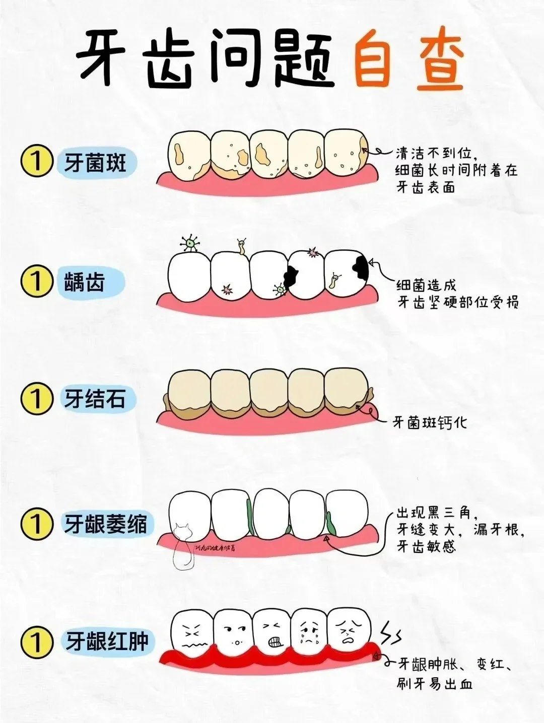 这种生物膜是口腔中常见的细菌群体,若不及时处理,可能成为龋齿和牙周