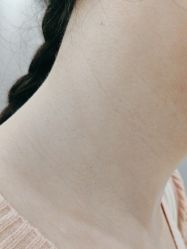 -美瑞莎创美医疗美容
