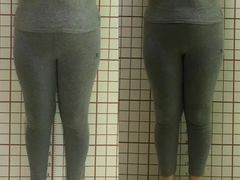 -修申骨雕小颜脊柱骨盆管理产后修复