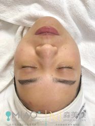 -韩国淼美颜皮肤管理官方直营店