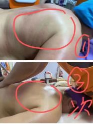 -丽减美瘦吧·减肥瘦身