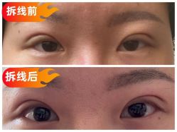 -素美医疗美容·西南眼鼻整形·修复基地